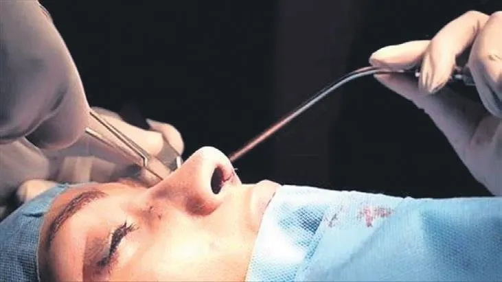 Doktor ve dişçilerin yüzde 400 vergi kaçırması!